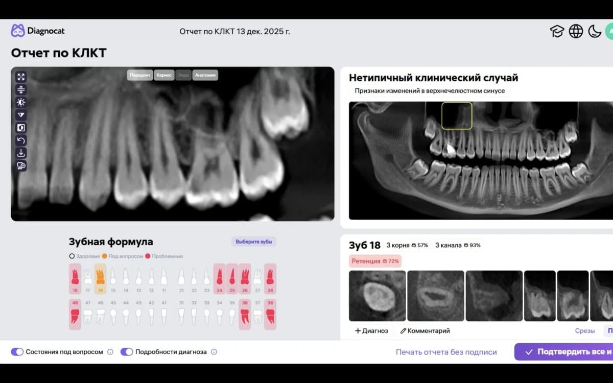 Отчёт по КЛКТ Diagnocat