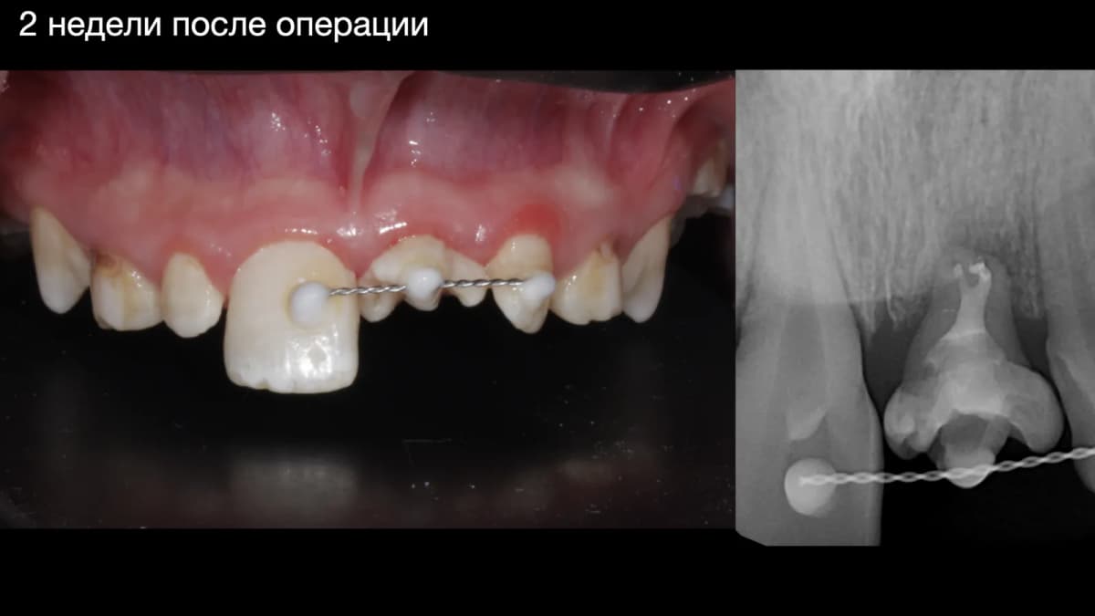 осмотр через 2 недели