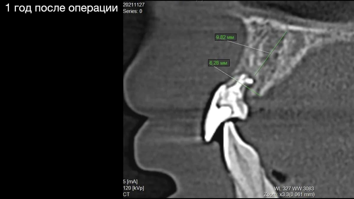 реформат через год