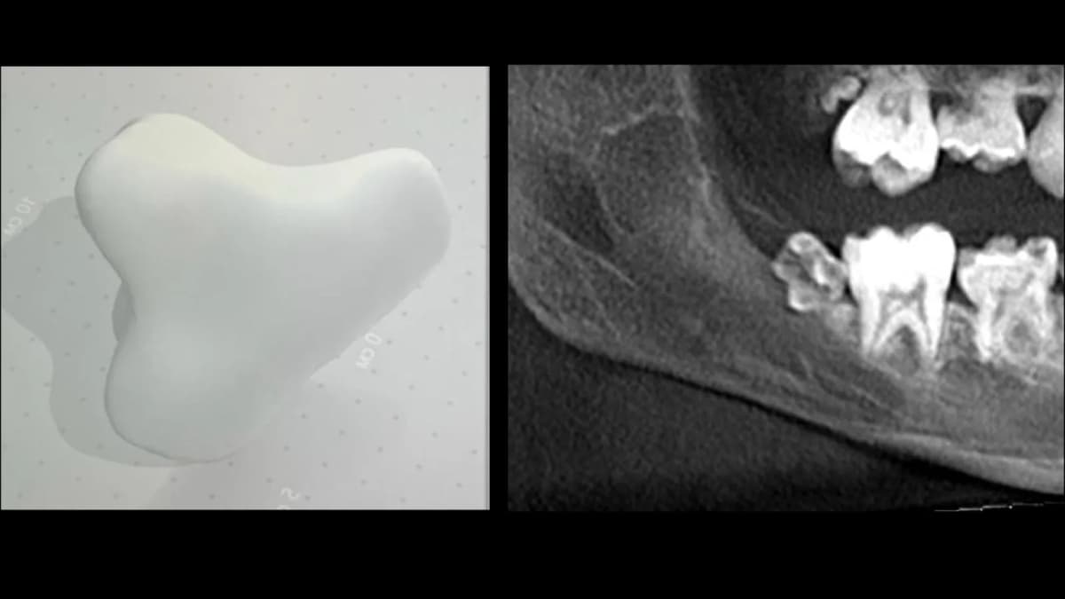 STL из Diagnocat